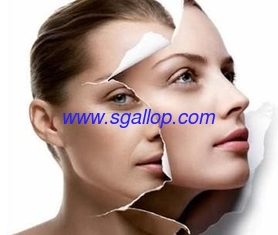 China Reborn Hot Sales Anti-wrinkle/Cross linked Injection Grade Hyaluronic Acid Filler hyaluronic acid dermal fillers supplier