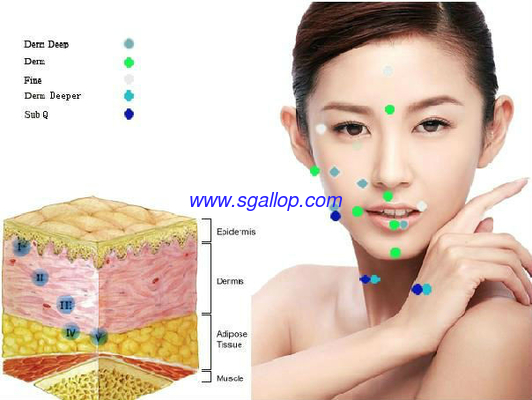 Hot Sales Reborn Anti-wrinkle/Cross linked Injection Grade Hyaluronic Acid derm filler hyaluronic acid wrinkle filler supplier